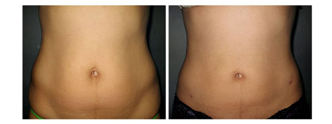 Jayasinghe Walter MD - Laser Surgery Center photo 4